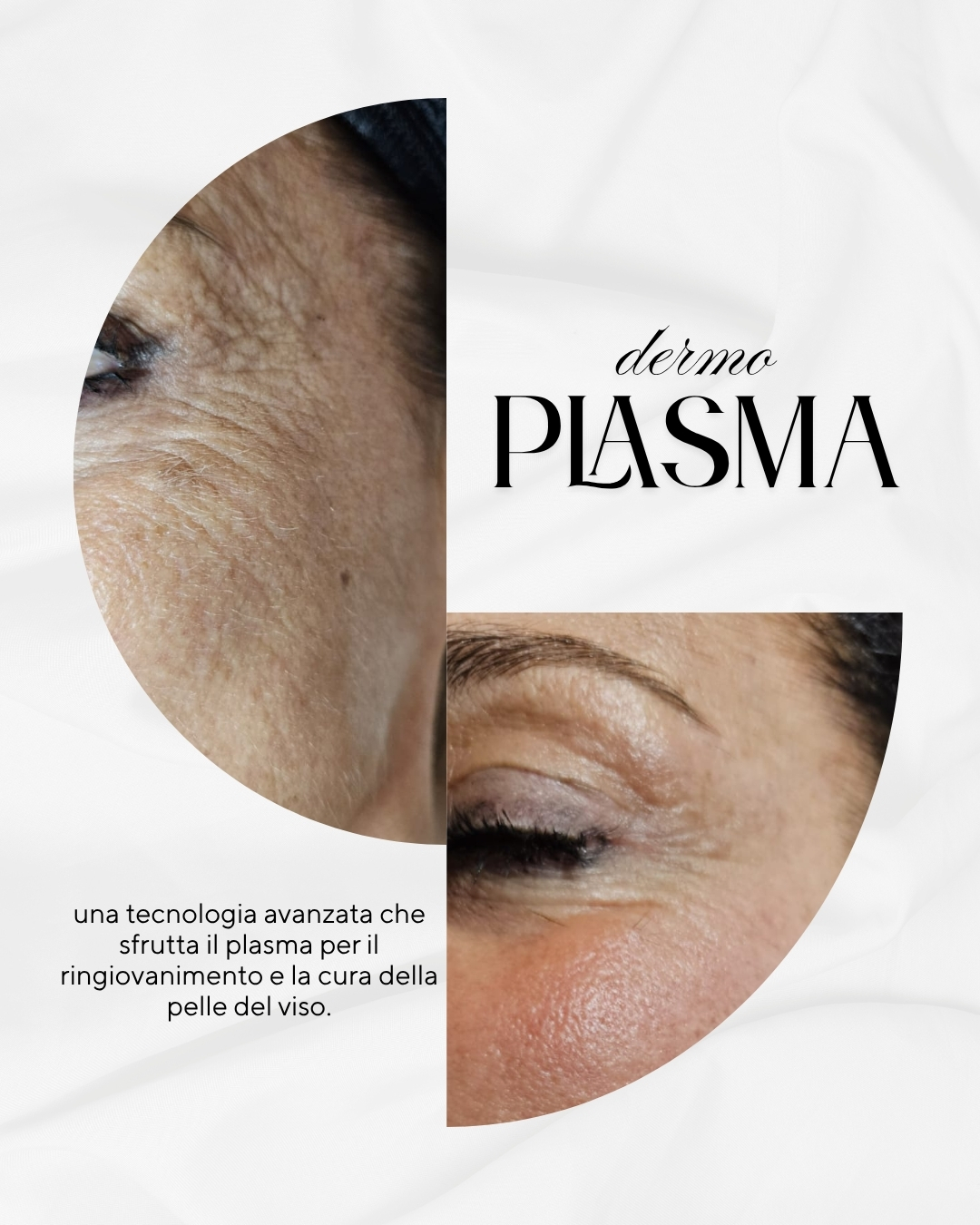 Trattamenti viso Guidonia -Dermo Plasma