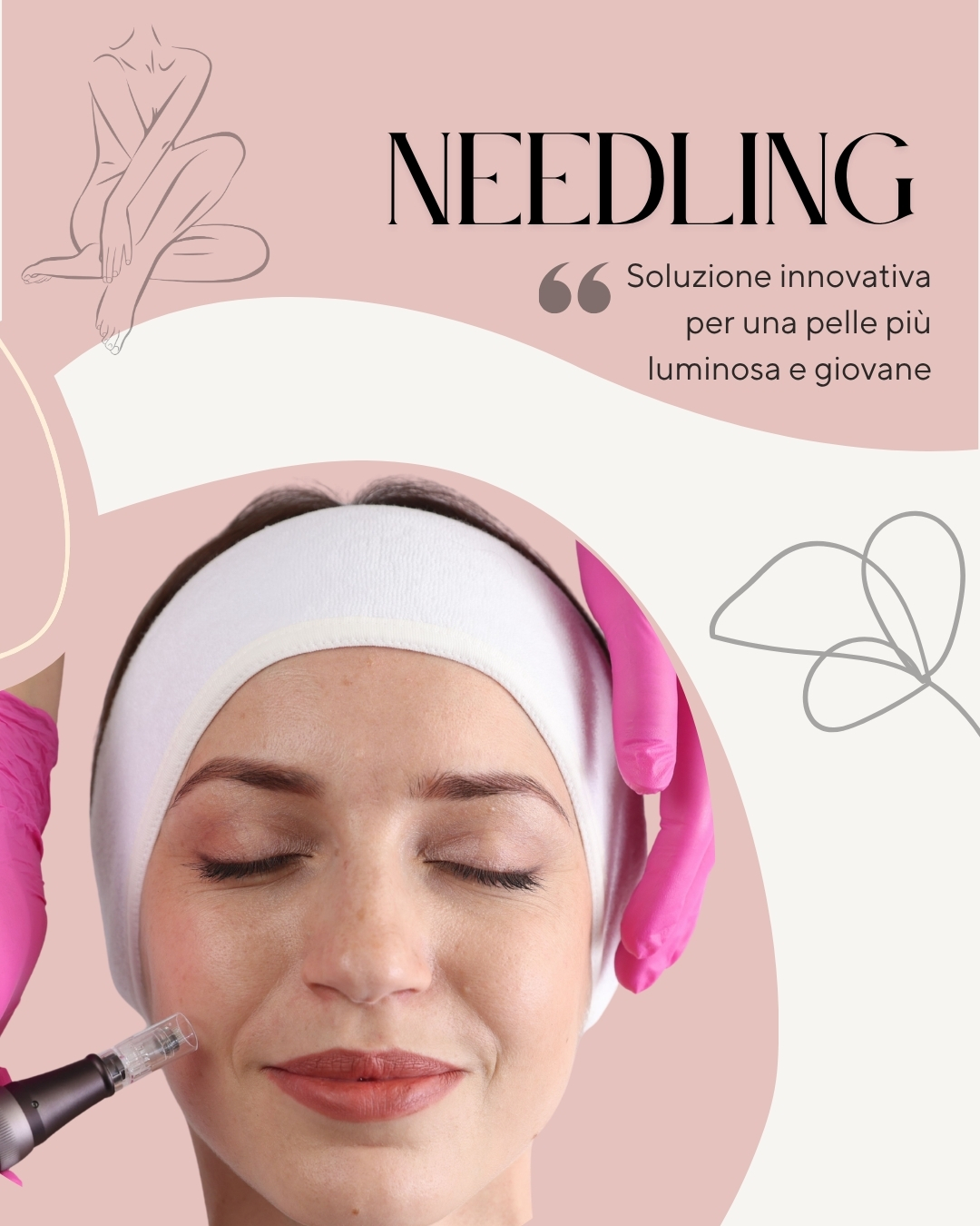 Trattamenti viso Guidonia -Needling